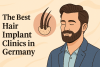 Die besten Haarimplantat-Kliniken in Deutschland bikrisohoj